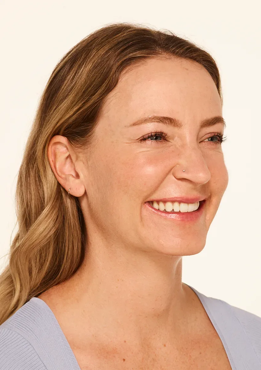 Before Wrinkle Relaxers TOX
