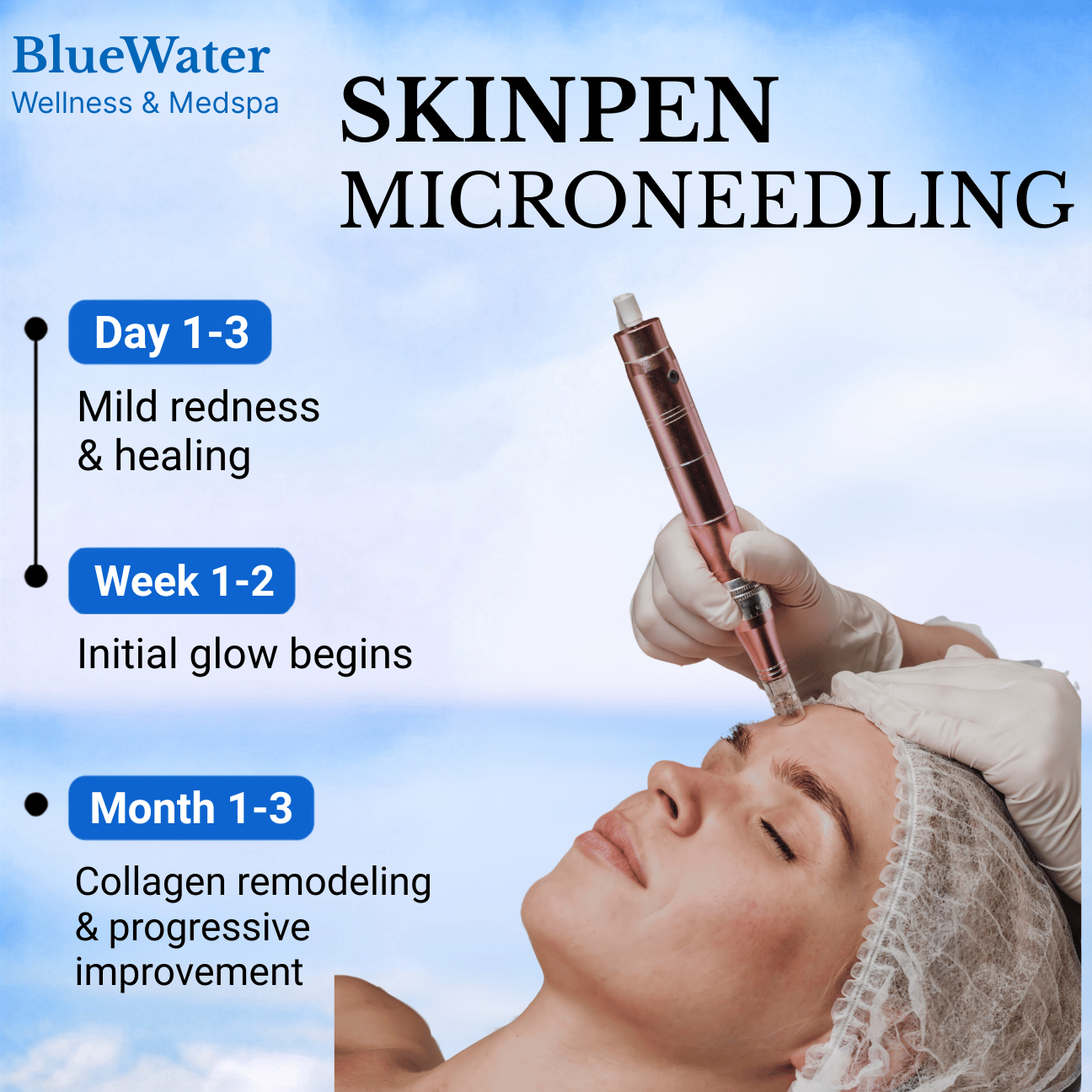 SkinPen Microneedling at BlueWater Wellness in Ponte Vedra, FL